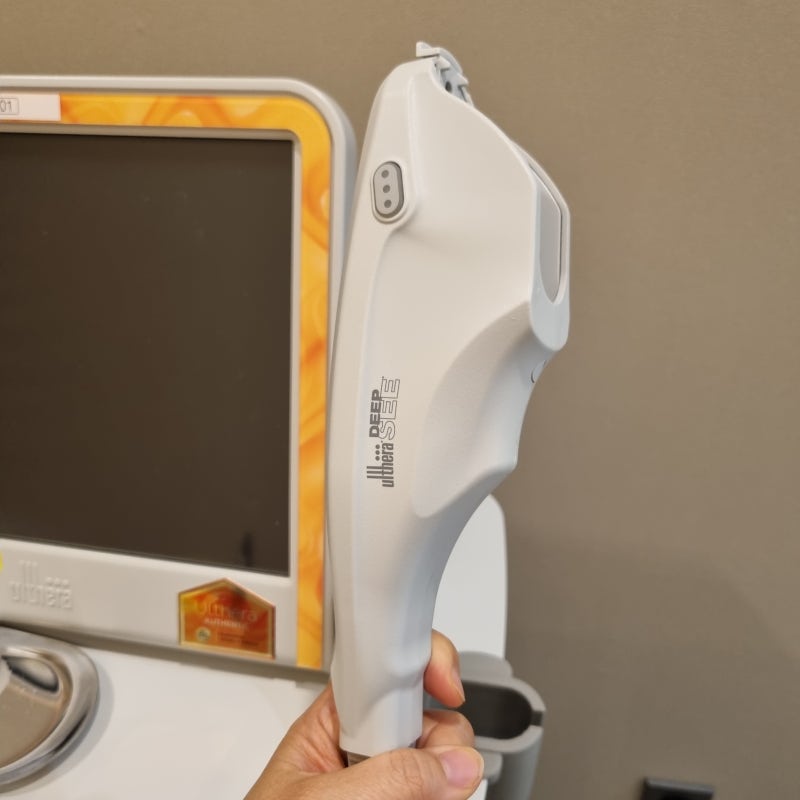 Ultherapy Prime Lifting for Structural Facial Rejuvenation