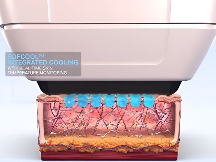 Gangnam Sofwave Price and Selection Guide: Unlock Your Flawless and Stunning Skin Today