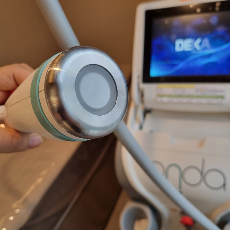 Body ONDA Lifting for Remarkable Arm Contouring: Unlock Your Flawless and Toned Silhouette Today