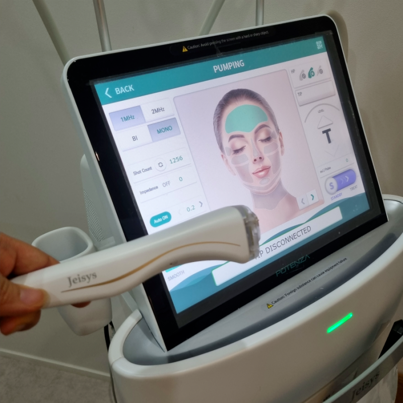 Potenza Acne Scar Guide: Strategic Tip Selection for Deep Ridges and Flawless Skin Refinement